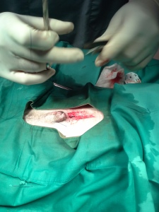 Sutures and closing